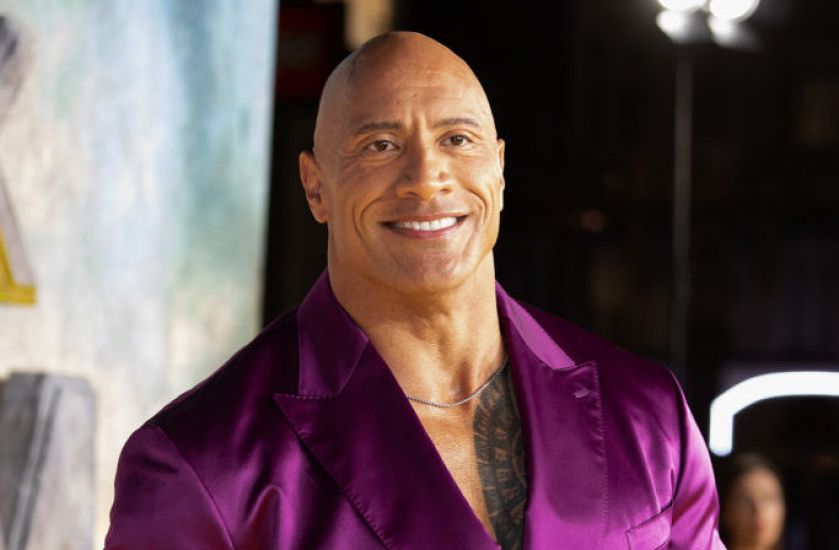 Dwayne Johnson Suffers Injury On Set Of The Smashing Machine